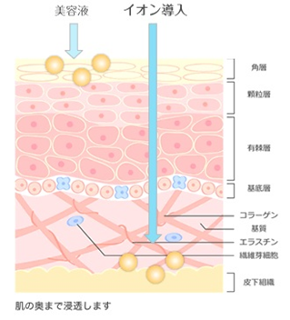 医療特許のイオン導入